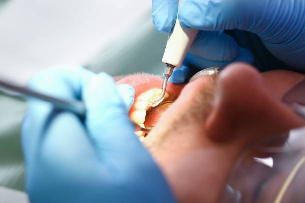 Best Emergency Dental Care for Broken or Chipped Teeth in Salunga, PA