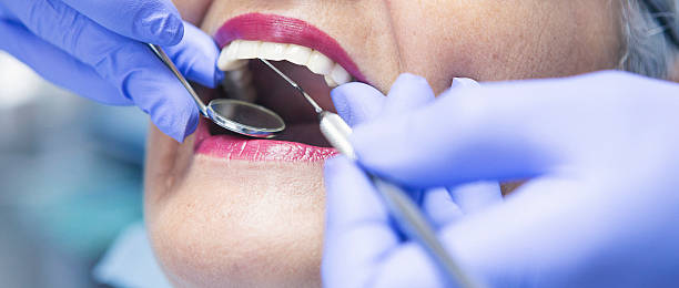 Best Emergency Tooth Extraction in Salunga, PA